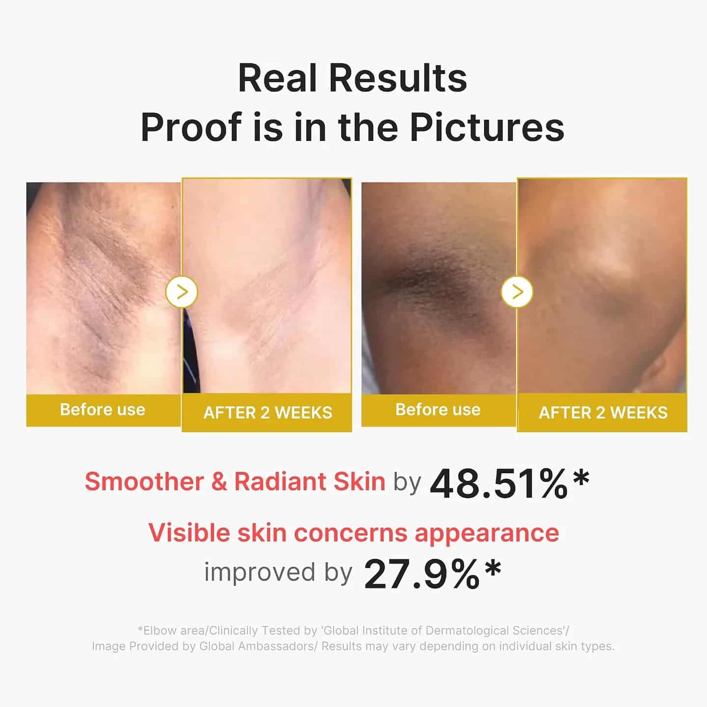 Medicube Kojic Acid Turmeric Body Peel Shot  4