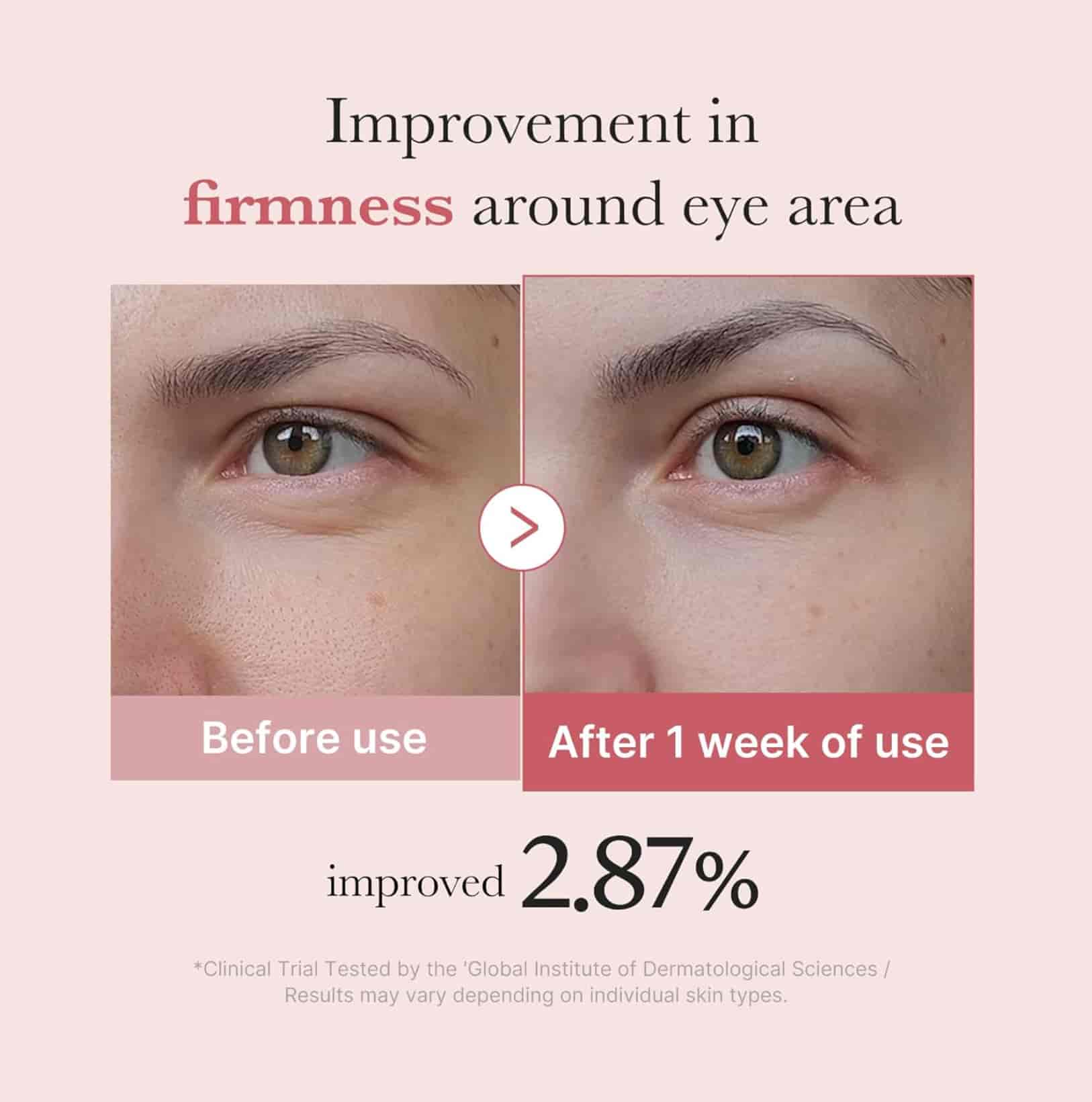 Medicube Pdrn Pink Peptide Eye Cream  4