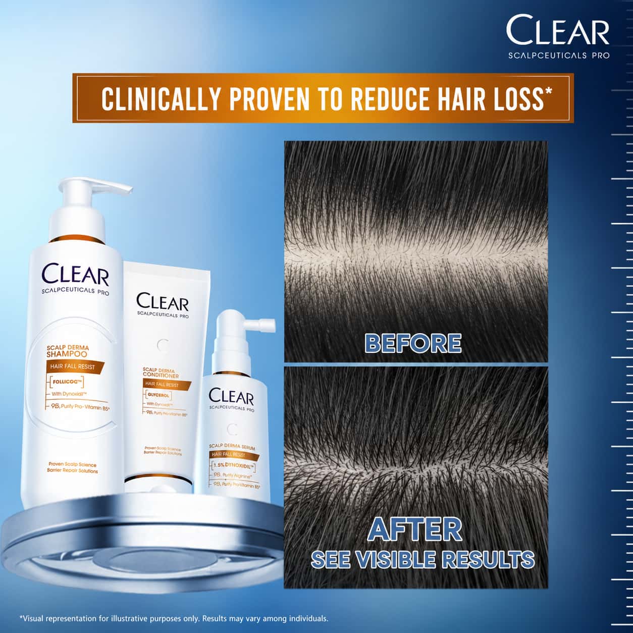 Clear Saclpceuticals Pro Scalp Derma Shampoo Hair Fall Resist  3