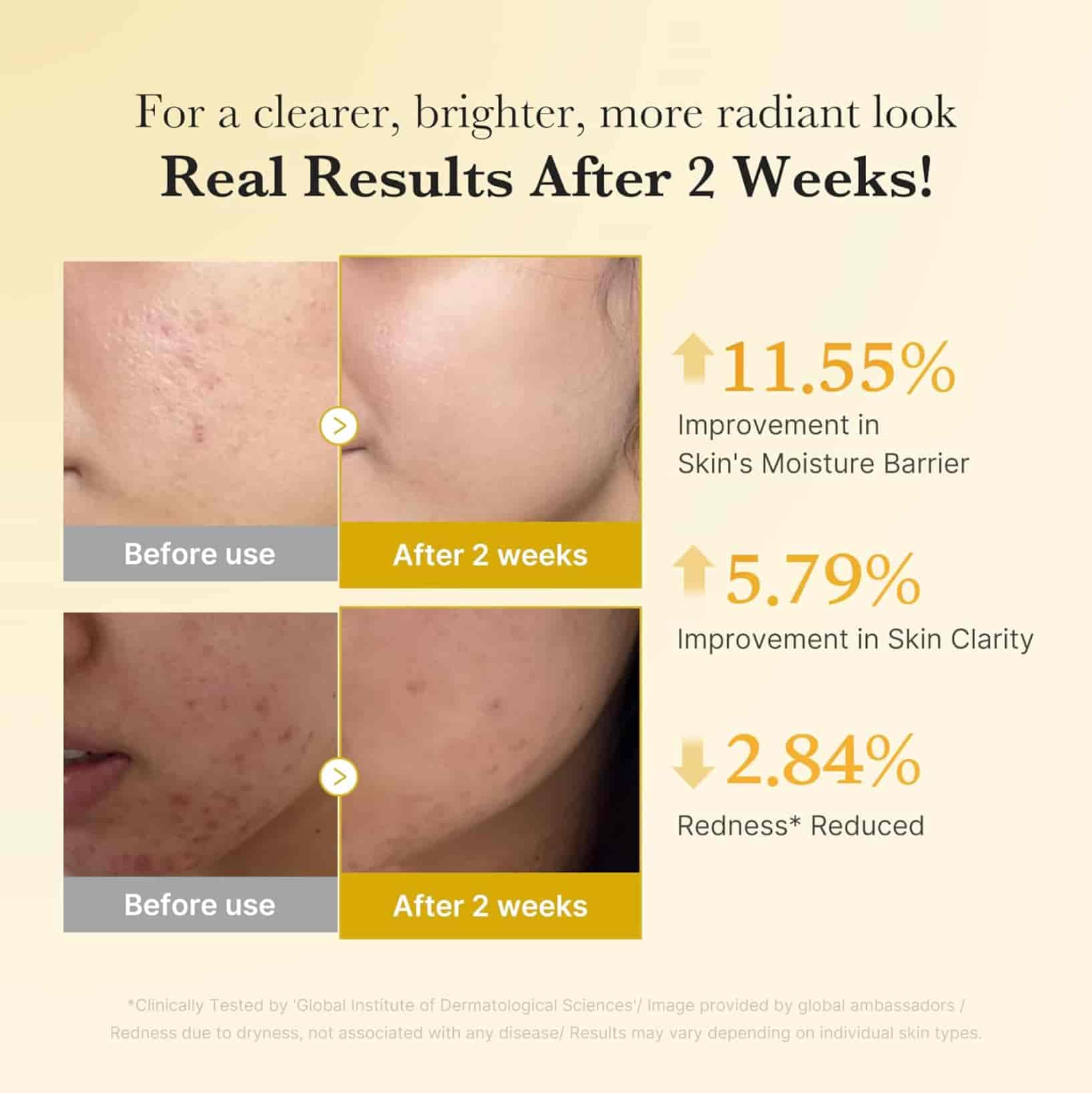 Medicube Kojic Acid Turmeric Niacinamide Serum 5
