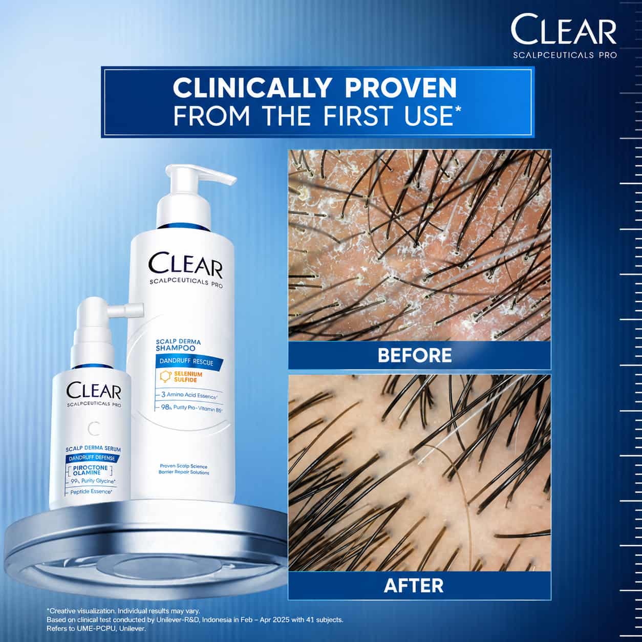 Clear Saclpceuticals Pro Scalp Derma Shampoo Dandruff Rescue  4