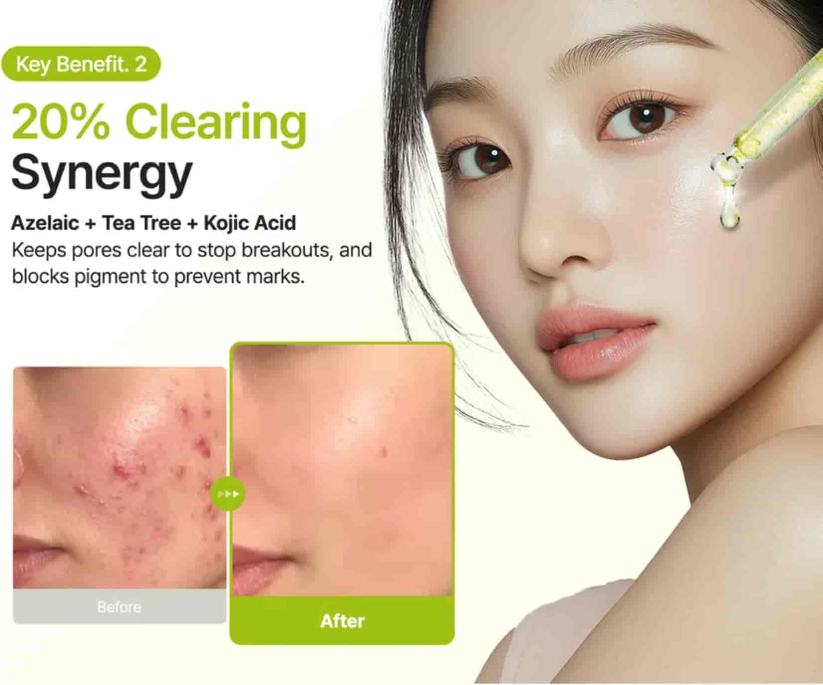 Purito SEOUL - Azelaic Acid 10 Kojic Tea Tree Serum 5