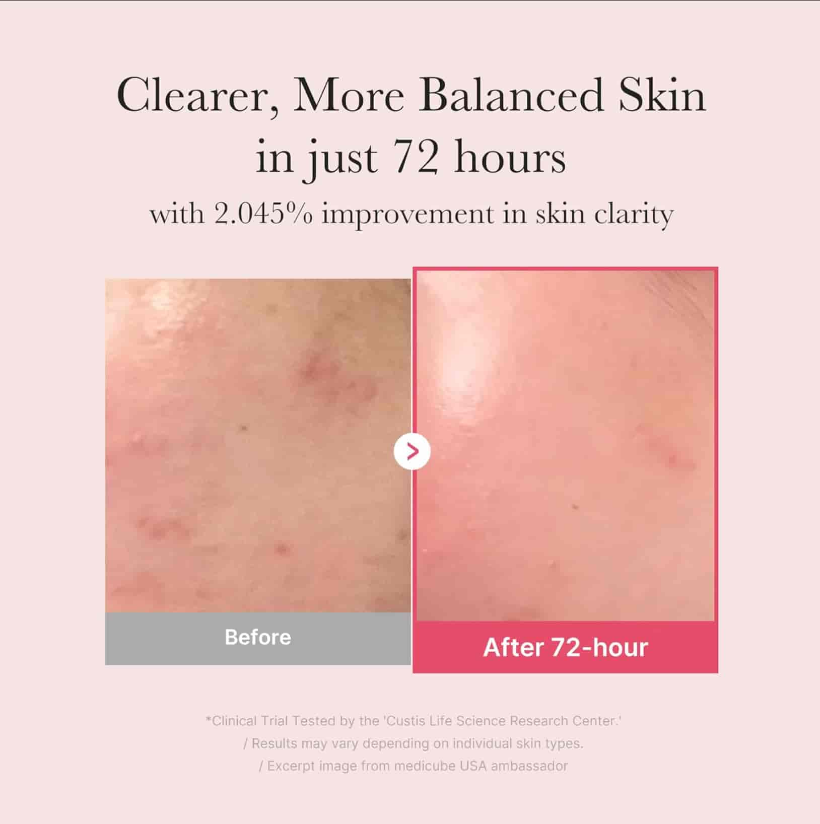 Medicube TXA Niacinamide Serum 2