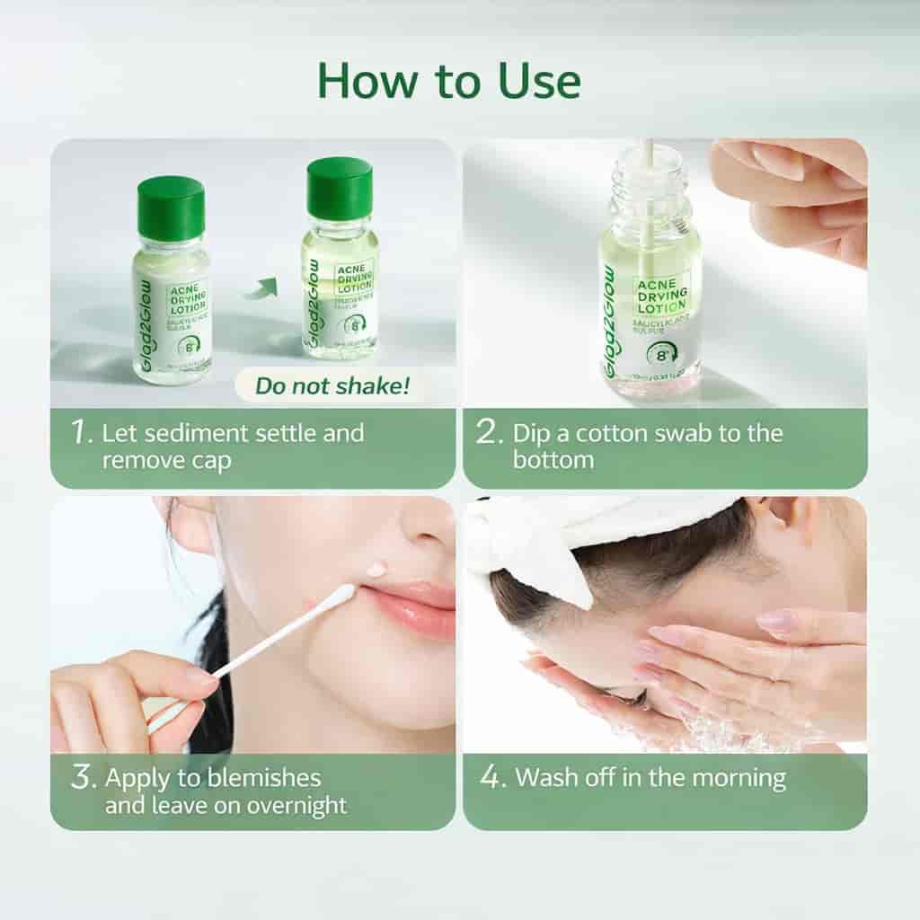Glad2Glow Acne Drying Lotion  3