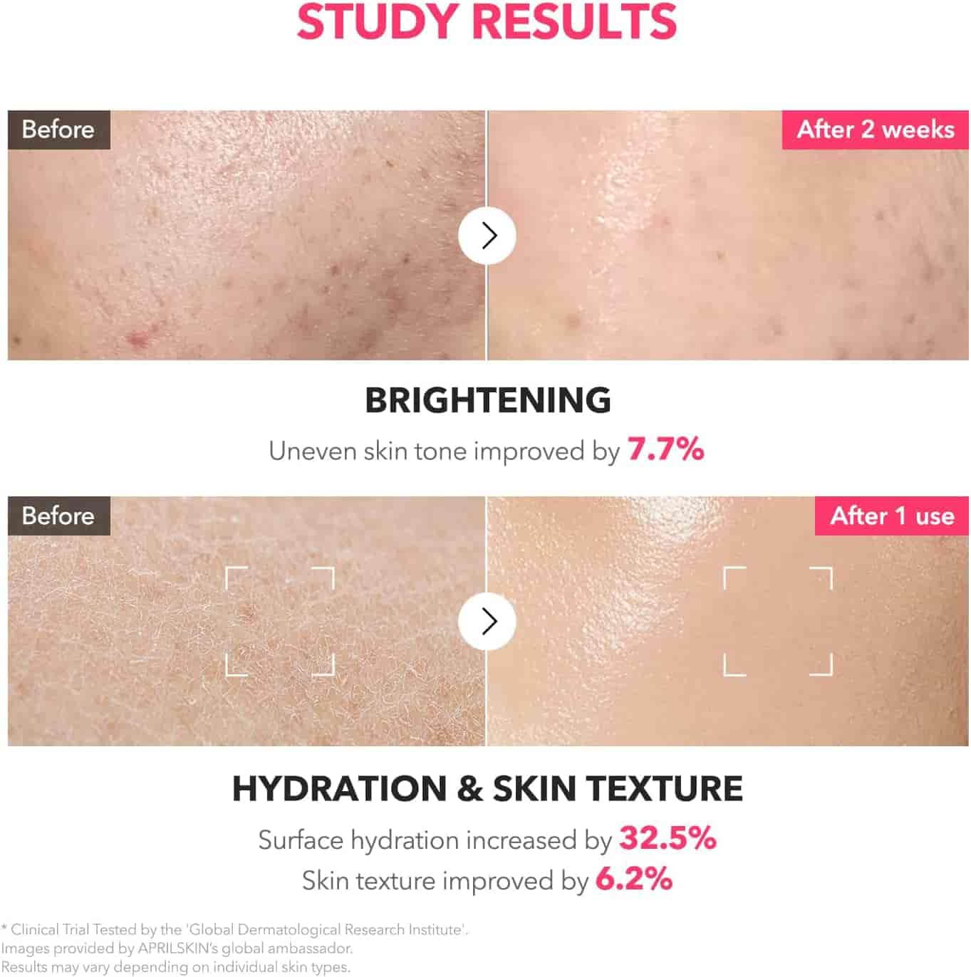 April Skin TXA+Niacinamide 99 Pink Milky Toner 7