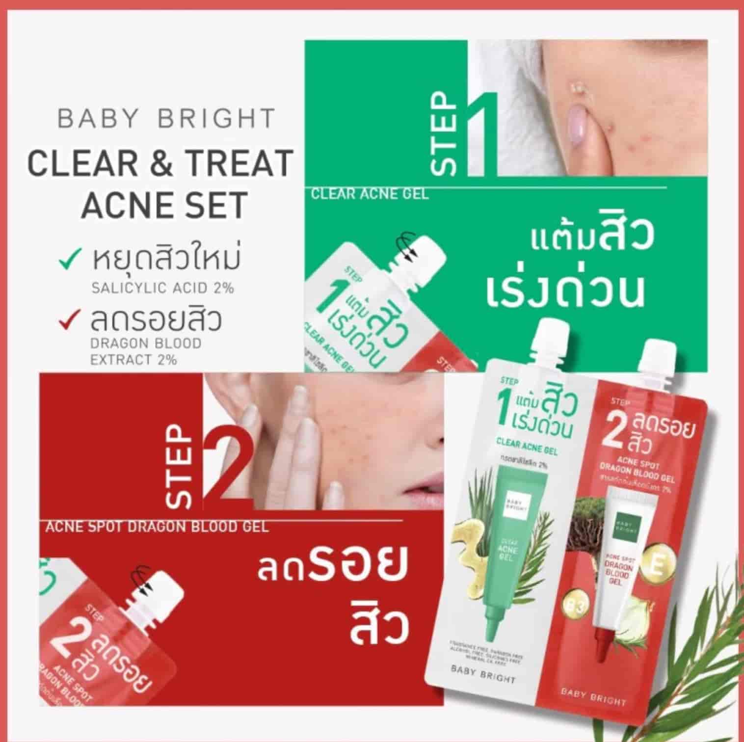 Baby Bright clear & treat acne set 4