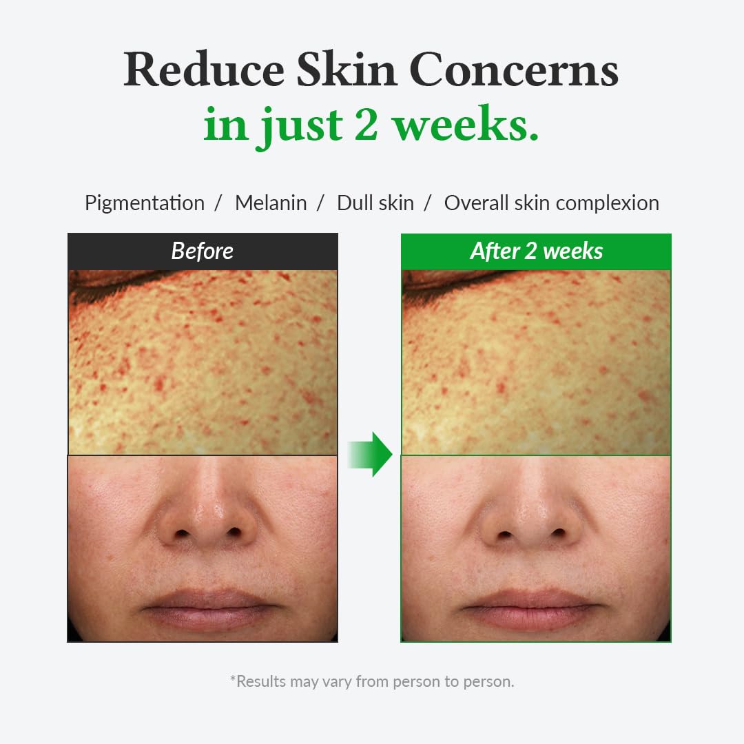 Dr Althea Gentle Vitamin C Serum  2