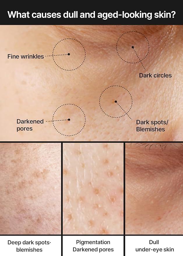 Celimax – Pore+Dark Spot Brightening Cream 4